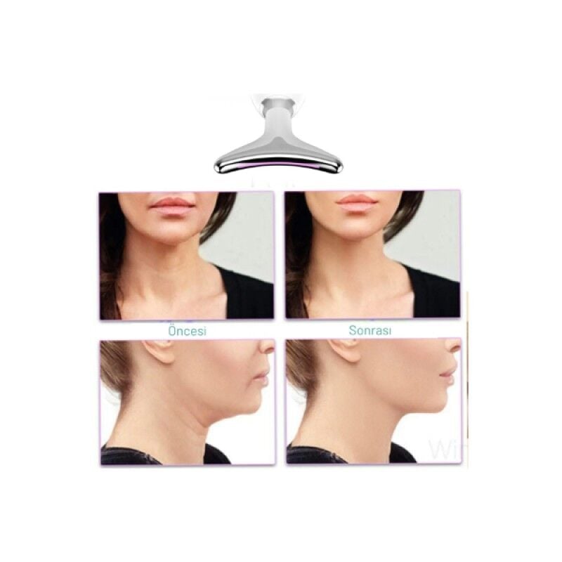 Kırışıklık Giderici Masaj Cihazı Işık Terapili Yüz Sıkılaştırıcı Lifting Cihazı Titreşimli Isıtmalı USB Şarjlı Profesyonel Cilt Bakım Aleti Ev Tipi